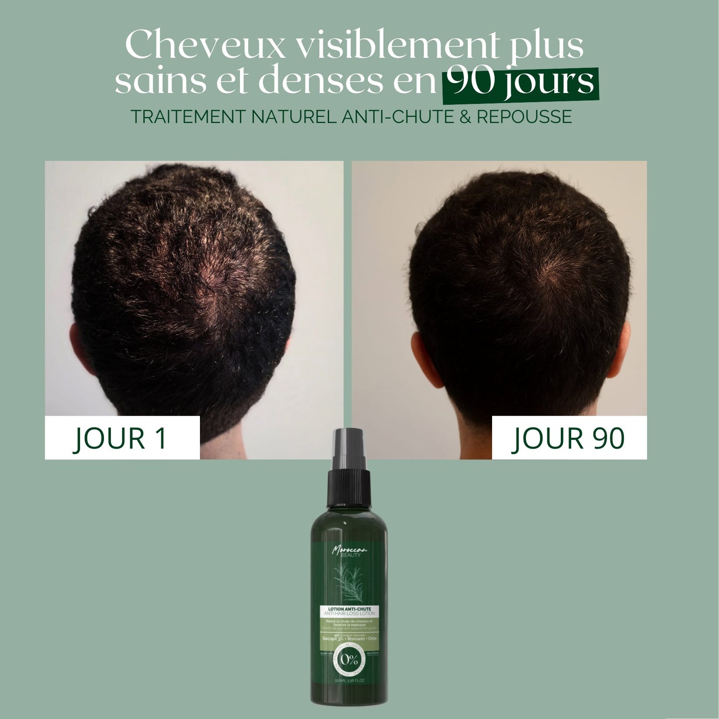 Lotion Naturelle Anti-Chute & Repousse – Baicapil 3% + Romarin – Cure 90 Jours | 100ml
